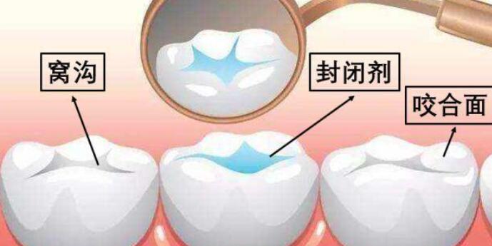 What is the price of dental implants in Beijing Tiantan Hospital?
