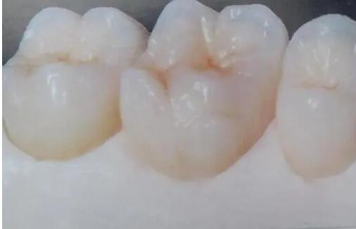 Nanjing Dental Implant Hospital is among the top 10 in the comprehensive ranking! The specific price is announced, and the brand competition is fierce!