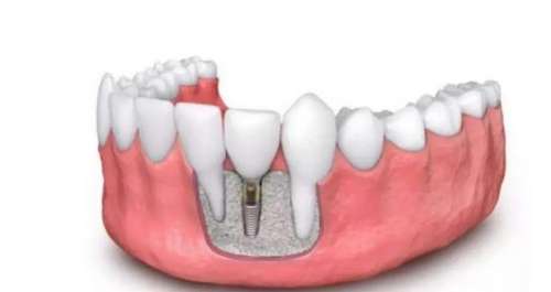 The list of top dental hospitals in Chongqing is released! Bookmark this list!