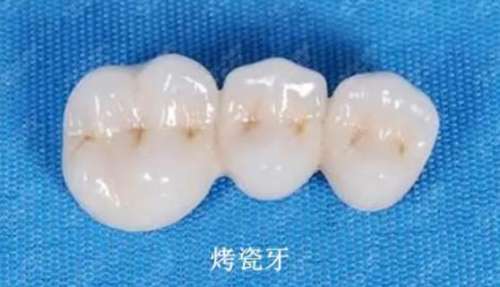 【Chongqing Dental Industry Leader】The whole city is eye-catching, and the skills are amazing! Follow the trend!