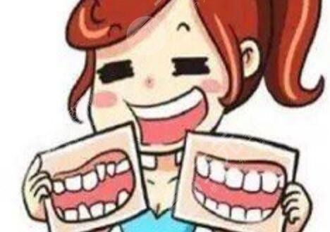 Orthodontic case sharing of Chengdu Xinqiao Stomatological Hospital