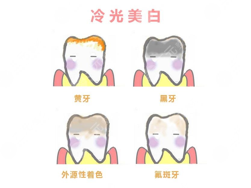 Teeth whitening questions and answers in Guiyang Baide Dental Hospital