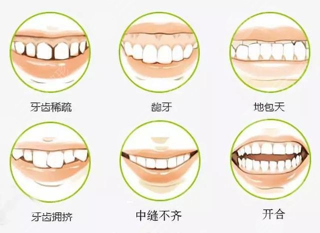 How long does orthodontic treatment take
