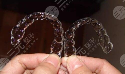 Nanjing Invisible Orthodontics Project Case Experience Feedback: