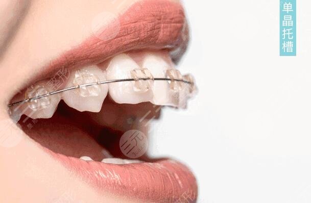 How much does it cost to get orthodontics?