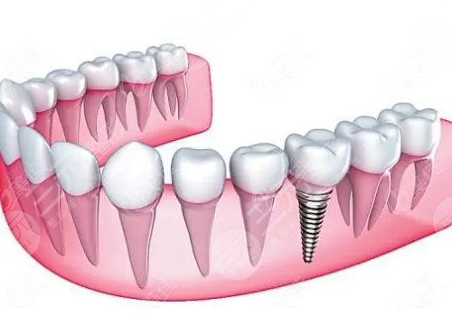 Chengdu Huamei Reunion Dental Hospital doctor introduced