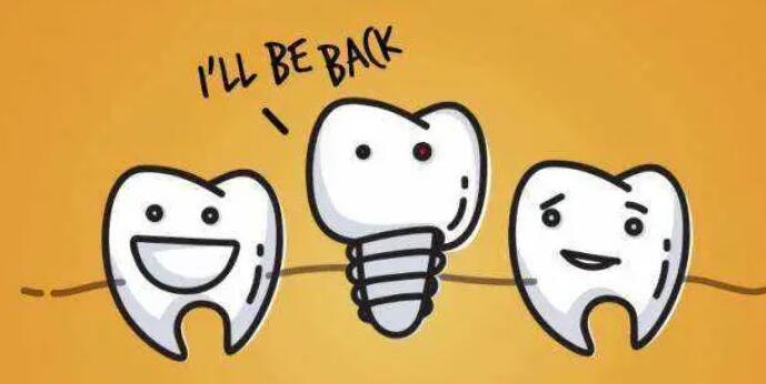 Dental implants