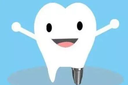 Dental implants